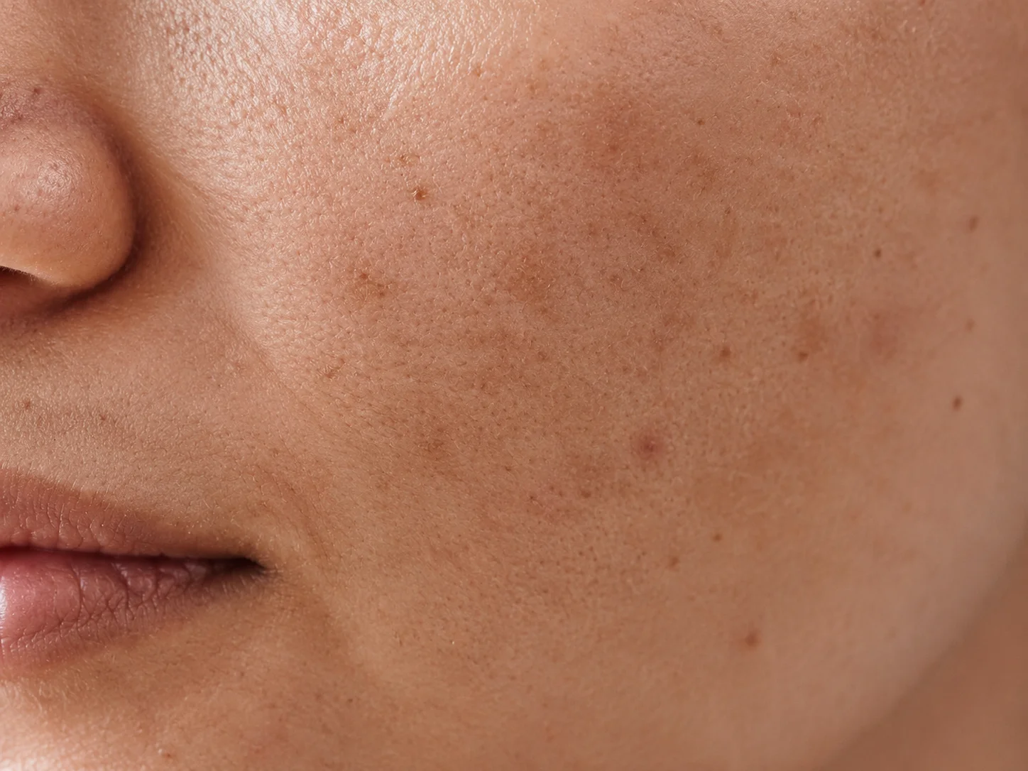 Targeted Clinical Formulations for Uneven Skin Tone & Pigmentation